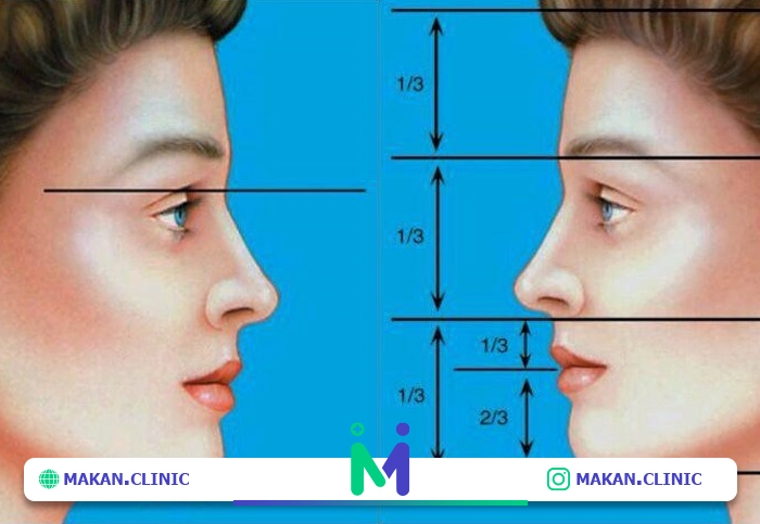 زیباشناسی چهره در جراحی بینی