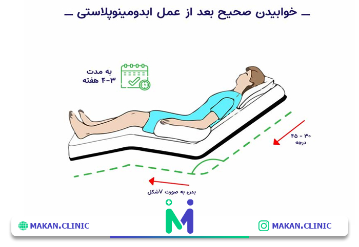 مراقبت‌های بعد از عمل ابدومینوپلاستی