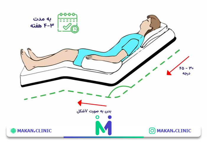 مراقبت های بعد لیپوماتیک